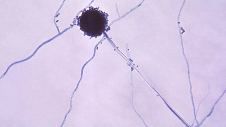 Global pandemic warning: Aspergillus deadly fungus mirrors HBO’s ‘The Last of Us’