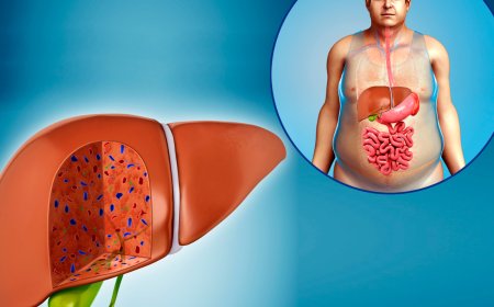 5 drinks that can cure fatty liver