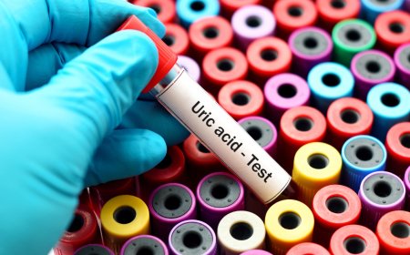 6 vegetables that are helpful in reducing uric acid levels in the body