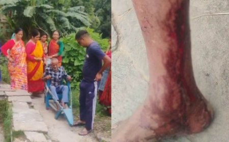 द्वाराहाट में बंदरों का आतंक: बुजुर्ग दिव्यांग को काटा, महिलाओं ने बचाई जान